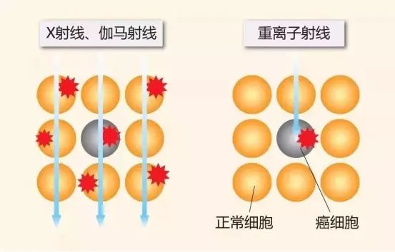 質(zhì)子重離子技術(shù)醫(yī)療險(xiǎn)可以報(bào)銷嗎？